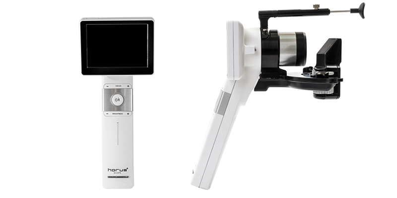 DSC300 Digital Anterior Imaging Camera